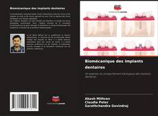 Bookcover of Biomécanique des implants dentaires