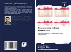 Bookcover of Биомеханика зубного имплантата