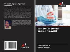 Capa do livro de Vari stili di protesi parziali rimovibili 