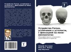 Bookcover of Устройство Forsus, устойчивое к усталости, с фиксацией на мини-имплантатах