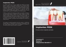 Implantes PEEK kitap kapağı
