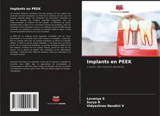 Implants en PEEK kitap kapağı