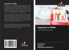 Bookcover of Impianti in PEEK