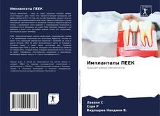 Buchcover von Имплантаты ПЕЕК