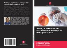 Bookcover of Avanços recentes no tratamento e manejo da leucoplasia oral