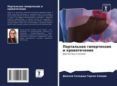Buchcover von Портальная гипертензия и кровотечение