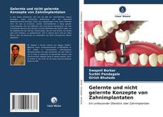 Portada del libro de Gelernte und nicht gelernte Konzepte von Zahnimplantaten