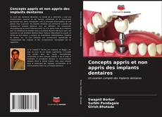 Bookcover of Concepts appris et non appris des implants dentaires