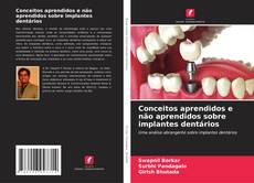 Capa do livro de Conceitos aprendidos e não aprendidos sobre implantes dentários 