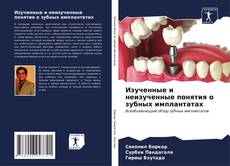 Bookcover of Изученные и неизученные понятия о зубных имплантатах