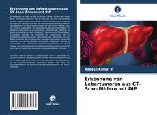 Erkennung von Lebertumoren aus CT-Scan-Bildern mit DIP kitap kapağı