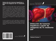 Bookcover of Detección de tumores hepáticos a partir de imágenes de TC mediante DIP
