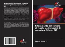 Bookcover of Rilevamento del tumore al fegato da immagini di scansione TC con DIP