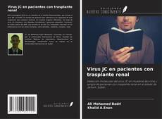 Capa do livro de Virus JC en pacientes con trasplante renal 