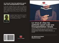 Buchcover von Le virus JC chez les patients ayant subi une transplantation rénale