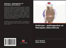 Portada del libro de Arthrose : pathogenèse et thérapies alternatives