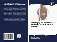 Обложка Остеоартрит: патогенез и альтернативные методы лечения