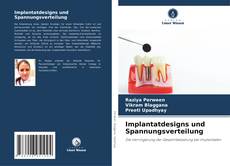 Implantatdesigns und Spannungsverteilung kitap kapağı