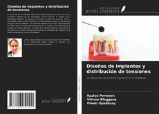 Bookcover of Diseños de implantes y distribución de tensiones
