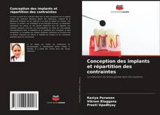 Bookcover of Conception des implants et répartition des contraintes