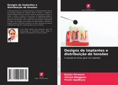 Copertina di Designs de implantes e distribuição de tensões