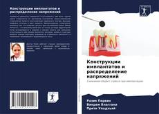 Bookcover of Конструкции имплантатов и распределение напряжений
