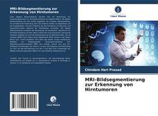 MRI-Bildsegmentierung zur Erkennung von Hirntumoren kitap kapağı