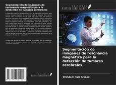 Buchcover von Segmentación de imágenes de resonancia magnética para la detección de tumores cerebrales