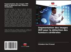 Segmentation des images IRM pour la détection des tumeurs cérébrales kitap kapağı