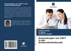 Bookcover of Anwendungen von CBCT in der Kinderzahnheilkunde