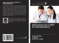 Bookcover of Aplicaciones de la CBCT en odontopediatría