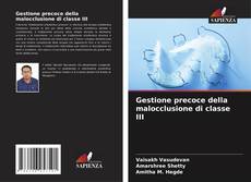 Bookcover of Gestione precoce della malocclusione di classe III