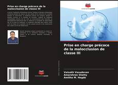 Bookcover of Prise en charge précoce de la malocclusion de classe III