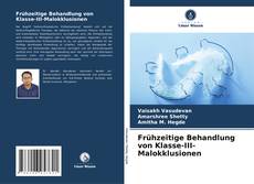 Bookcover of Frühzeitige Behandlung von Klasse-III-Malokklusionen