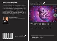 Bookcover of Transfusión sanguínea