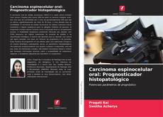 Bookcover of Carcinoma espinocelular oral: Prognosticador histopatológico