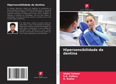 Capa do livro de Hipersensibilidade da dentina 