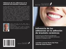 Copertina di Influencia de los adhesivos en la adhesión de brackets cerámicos