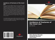 Buchcover von Incidence of fractures of the lower jaw