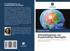 Bookcover of Schnelldiagnose von Kryptokokken-Meningitis
