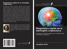 Diagnóstico rápido de la meningitis criptocócica kitap kapağı