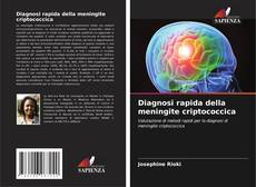 Capa do livro de Diagnosi rapida della meningite criptococcica 