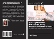 Bookcover of Visión general del diagnóstico de las enfermedades pulmonares