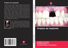 Projeto de implante kitap kapağı
