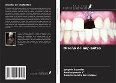 Diseño de implantes kitap kapağı