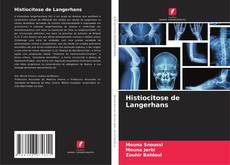 Histiocitose de Langerhans kitap kapağı