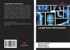 Bookcover of Langerhans histiocytosis