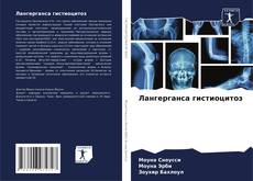 Bookcover of Лангерганса гистиоцитоз