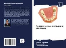 Capa do livro de Керамические вкладки и накладки 