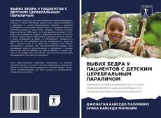 Bookcover of ВЫВИХ БЕДРА У ПАЦИЕНТОВ С ДЕТСКИМ ЦЕРЕБРАЛЬНЫМ ПАРАЛИЧОМ